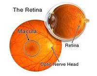 Retina Treatment